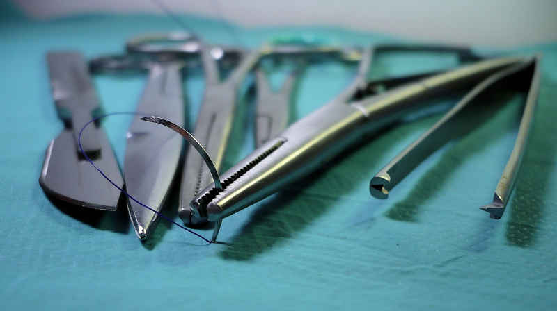 L'intervento di circoncisione non fa male perché eseguito in anestesia
