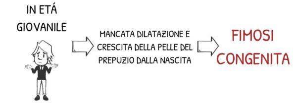 Fimosi Congenita